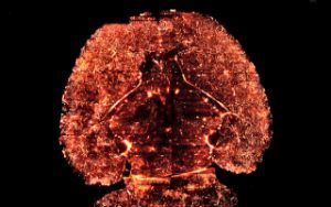 El cerebro | Ese órgano desconocido