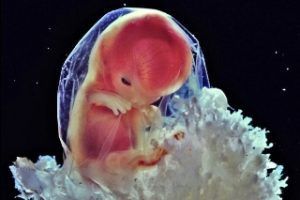 Un embrión de 12 semanas siente conscientemente el dolor