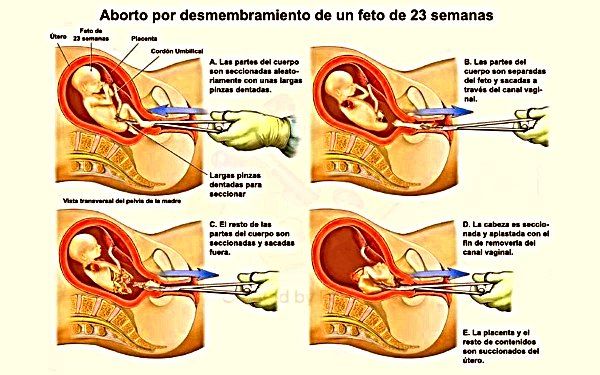 La Declaración de Derechos y la Cultura de la Muerte